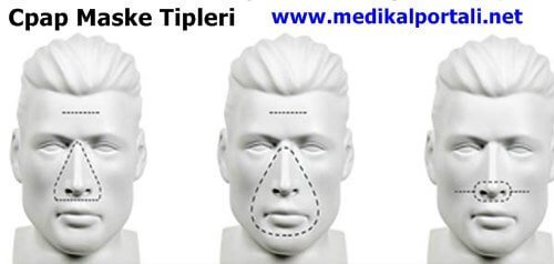 Cpap Maskesi Nedir Neden Nasıl Kullanılır Çeşitleri Nelerdir? 2 fisher paykel cpap mask, cpap maske tam yüz, cpap maske forumu, cpap cihazı maskesi çeşitleri, cpap-bpap maskesi kafa bandı, resmed cpap oto cpap maske fiyatları, tam yüz cpap maske kadıköy,
