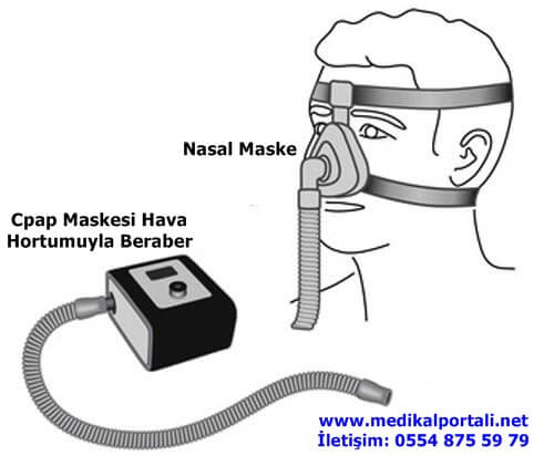 obstrüktif uyku apnesi tedavisi sendorumu, obstrüktif uyku apnesi ne demek belirtileri nelerdir, obstrüktif uyku apne hipopne sendromu, obstrüktif sleep apne nedir, pozisyonel obstruktif uyku apnesi, bebeklerde obstrüktif uyku apne sendromu, hafif dereceli obstrüktif uyku apne sendromu