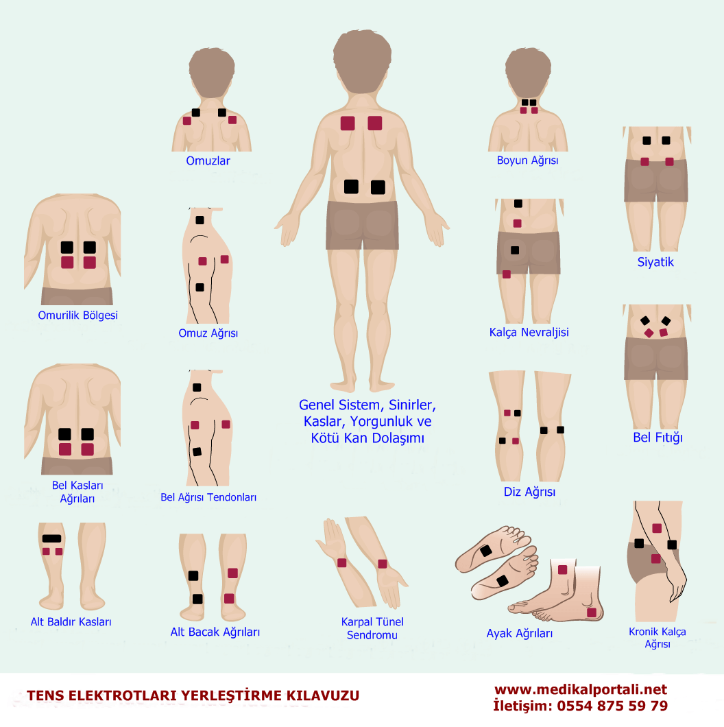 fizik tedavi tens cihazı ne işe yarar, tens cihazı tavsiye, tens cihazı uygulama noktaları, tens cihazı istanbul, tens cihazı ayarları, tens cihazı ve ayak masaj terapisti baş diz sırt ağrısı boyun fıtığı boyun düzleşmesi blok diyagramı nasıl bağlanır, compex comfy tens cihazı, tens cihazı etkileri