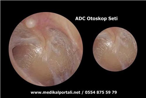 otoskop nedir ne ise yarar teknik şartnamesi