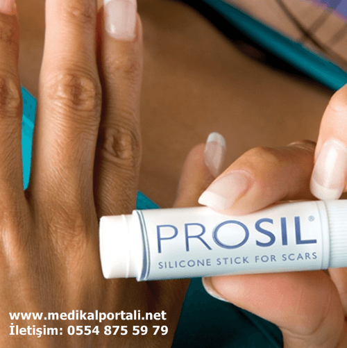 Prosil Krem Skar Tedavisi 4,25 gr. 3 prosil-turkiye-nerede-satilir-satin-alinir-fiyatı-en-ucuz-iceriği-nedir