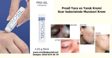 prosil-nasil-kullanilir-nerede-bulunur-en-ucuz-faydalari-skar-tedavisi