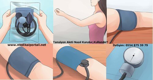 Tansiyon Aleti Nedir, Türleri Nelerdir, Nasıl Kullanılır ve Alırken Nelere Dikkat Etmeliyiz? 2 tansiyon-aleti-nasil-kurulur-kullanilir-nasil-calisir-tibbi-cihazmidir-degerleri-nelerdir