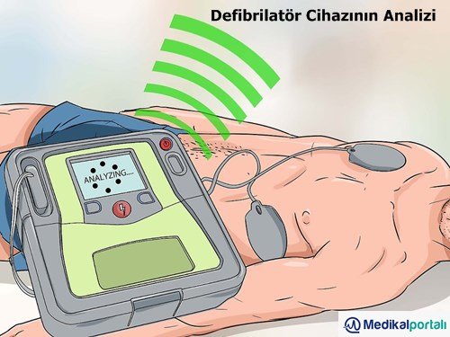 Defibrilatör Nasıl Kullanılır? Uygulama Aşamaları Nelerdir? 9 aed-defibrilator-cihazinin-bolümleri-cesitleri-ozellikleri-hangi-durumlarda-kullanilir