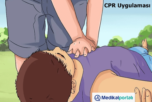 Defibrilatör Nasıl Kullanılır? Uygulama Aşamaları Nelerdir? 4 cpr-uygulamasi-ne-demek-nasil-yapilir-asamalari-talimati-sirasi-onemi-nedir
