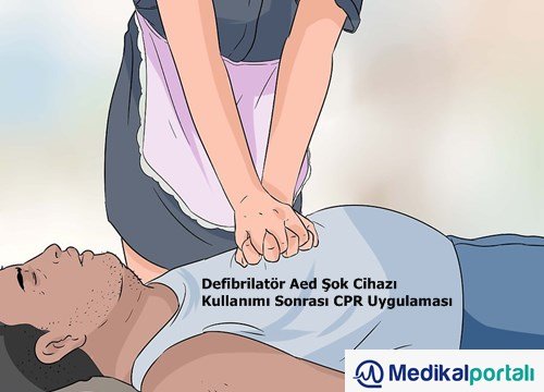 Defibrilatör Nasıl Kullanılır? Uygulama Aşamaları Nelerdir? 11 defibrilator-aed-otomatik-eksternal-sok-cihazinin-kullanimi-cpr-uygulamasi-nasil-yapilir-egitimi-nedir