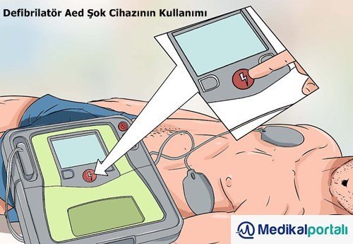 Defibrilatör Nasıl Kullanılır? Uygulama Aşamaları Nelerdir? 10 defibrilator-aed-otomatik-eksternal-sok-cihazinin-kullanimi-nerede-hangi-durumlarda-kullanilir