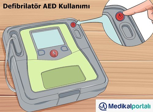 Defibrilatör Nasıl Kullanılır? Uygulama Aşamaları Nelerdir? 6 defibrilator-cihazi-nasil-kullanilir-amaclari-kullanim-kilavuzu-talimati