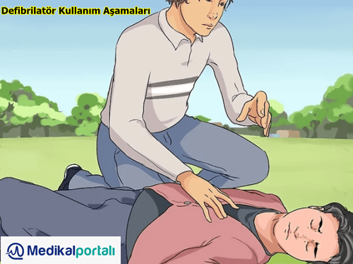 Defibrilatör Nasıl Kullanılır? Uygulama Aşamaları Nelerdir? 2 defibrilator-kimlere-yapilir-yetişkin-ve-bebege-nasil-uygulanir-kullanilir-