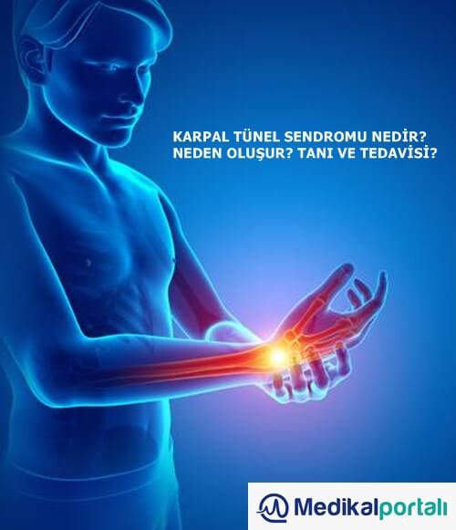 karpal-tunel-sendromu-el-bilek-meslek-hastaligi-nedir-neden-olusur-tedavi-edilirmi-hastalik-geceröi-evde-egzersiz-uygulamalari