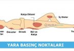 basi-yarasi-nedir-neden-olusur-asamalari-iyilesme-evreleri-tani-tedavi-yontemleri-basinc-noktalari-nelerdir-yatak-yarasi-pansumani-nasil-yapilir-iyilesirmi