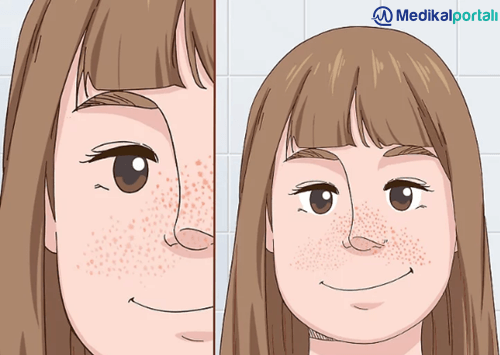 kirmizi-infrared-isiticili-led-lambanin-kas-eklem-sinir-hastaliklari-uzerindeki-etkileri-nelerdir-nasil-tedavi-edilir-uygulanir-fototerapi-faydalari