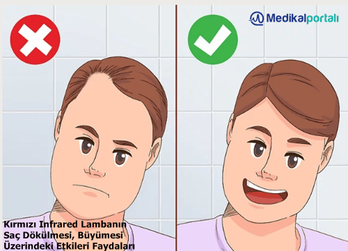 kirmizi-infrared-isiticili-led-lambanin-sac-dokulmesi-buyumesi-hastaliklari-uzerindeki-etkileri-nelerdir-nasil-tedavi-edilir-uygulanir-fototerapi-faydalari