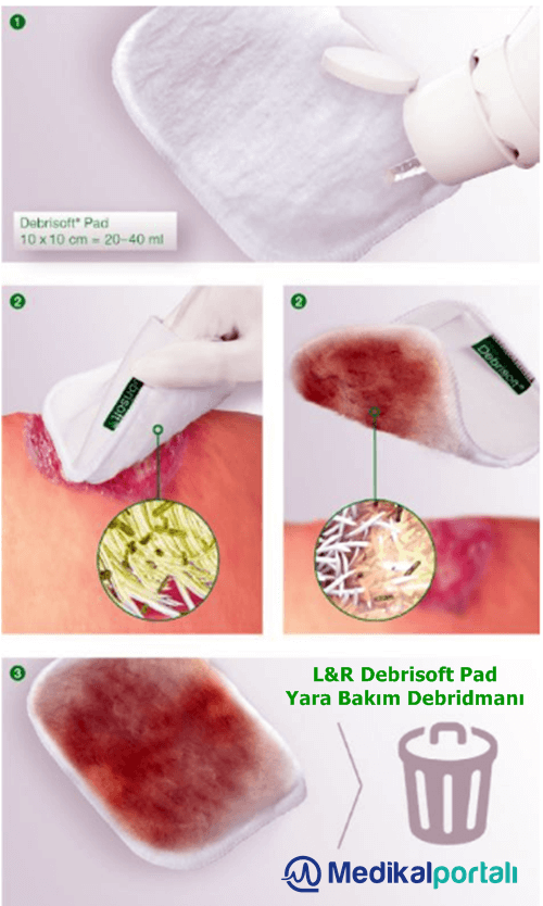 Lohmann Rauscher Debrisoft Debridman Pad 4 lohmann-rauscher-debrisoft-debridman-pedi-en-ucuz-uygun-fiyata-nasil-satin-alinir-ne-ise-yarar