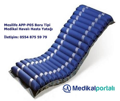 en-ucuz-kaliteli-boru-tipi-havali-hasta-yatagi-fiyatlari-nereden-nasil-satin-alinir-kullanma-kilavuzu-urun-ozellikleri