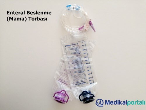 Enteral Beslenme Nedir, Mama Torbası Türleri Nelerdir? 3